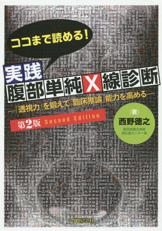 ココまで読める!実践腹部単純X線診断第2版