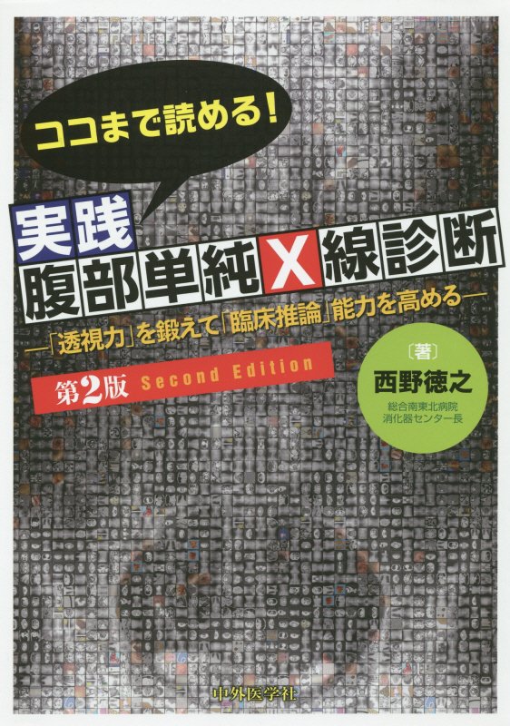 目の前の腹部単純Ｘ線写真に隠れた様々な情報ー患者の身に起きている今のできごとーを、「マニュアル」に頼るのではなく「自分の心」ですくい上げるための思考の方法・手順・注意点ー「臨床推論」能力を高めるためのコツをていねいに説明。今までありそうでなかった視点で書かれた診断書。