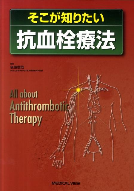そこが知りたい抗血栓療法