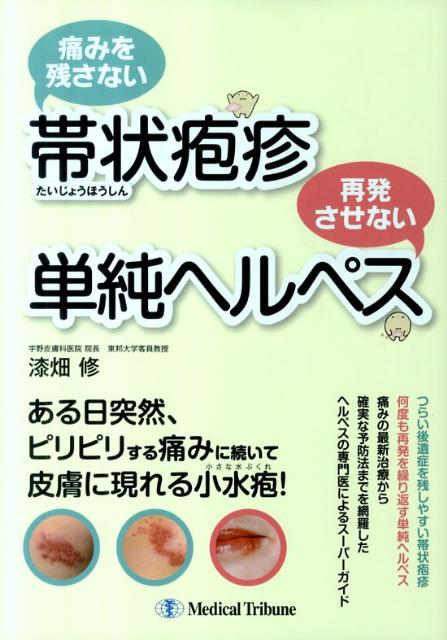 痛みを残さない帯状疱疹再発させない単純ヘルペス [ 漆畑修 ]