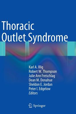 Thoracic Outlet Syndrome THORACIC OUTLET SYNDROME 2013/ [ Karl A. Illig ]