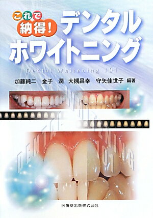 これで納得！デンタルホワイトニング Dental Whitening 101 加藤純二