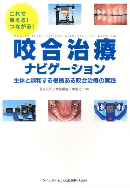 咬合治療ナビゲーション