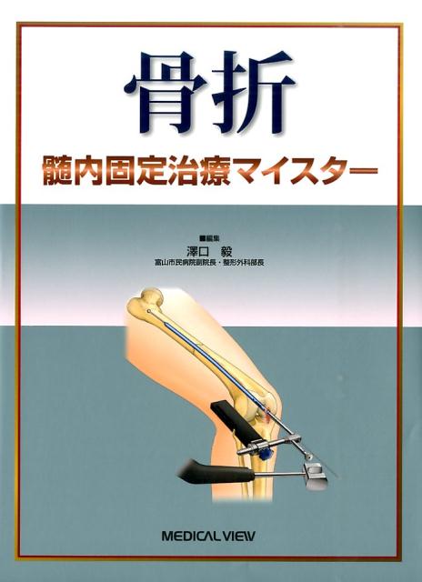 骨折髄内固定治療マイスター [ 澤口毅 ]のサムネイル