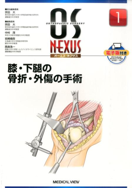 楽天市場】os nexus 整形外科の通販 楽天市場】os nexus 整形外科の通販