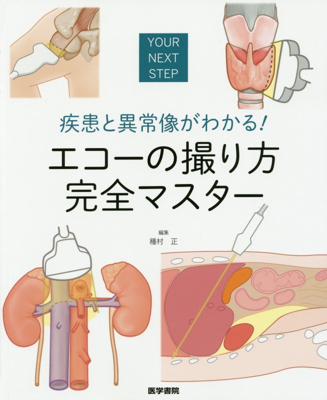 疾患と異常像がわかる！　エコーの撮り方　完全マスター