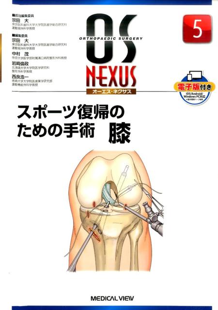 楽天楽天ブックススポーツ復帰のための手術膝 （OS　NEXUS） [ 宗田大 ]