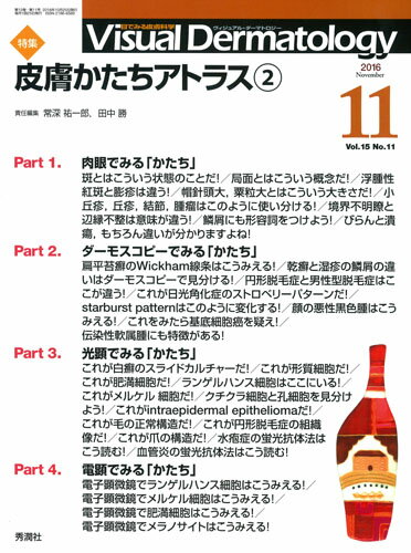 Visual　Dermatology　2016年11月号Vol．15No．11