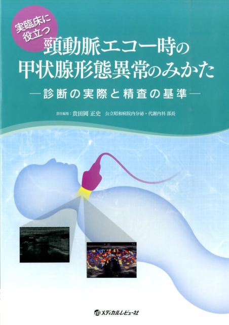 実臨床に役立つ頚動脈エコー時の甲状腺形態異常のみかた