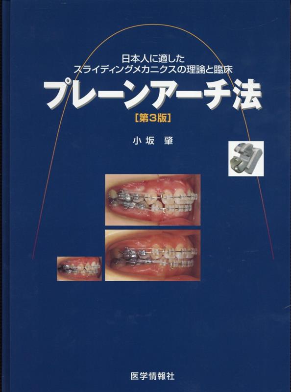 プレーンアーチ法第3版 日本人に適したスライディングメカニクスの理論と臨床 [ 小坂肇 ]