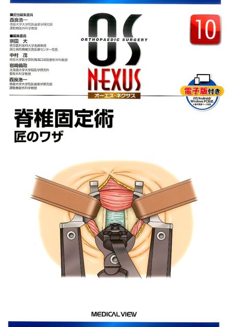 脊椎固定術 匠のワザ （OS　NEXUS） [ 西良浩一 ]