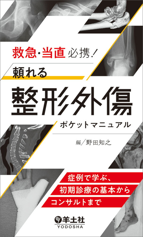 救急・当直必携！頼れる整形外傷ポケットマニュアル [ 野田　知之 ]