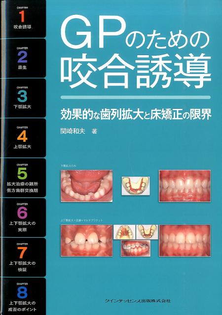 GPのための咬合誘導
