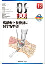 高齢者上肢骨折に対する手術 （OS NEXUS（電子版付き） 13） 岩崎 倫政