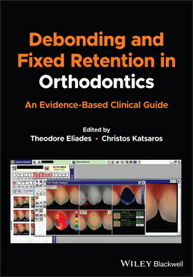 Debonding and Fixed Retention in Orthodontics: An Evidence-Based Clinical Guide DEBONDING & FIXED RETENTION IN [ Theodore Eliades ]
