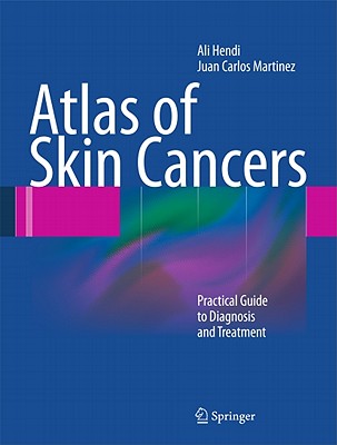 Atlas of Skin Cancers: Practical Guide to Diagnosis and Treatment