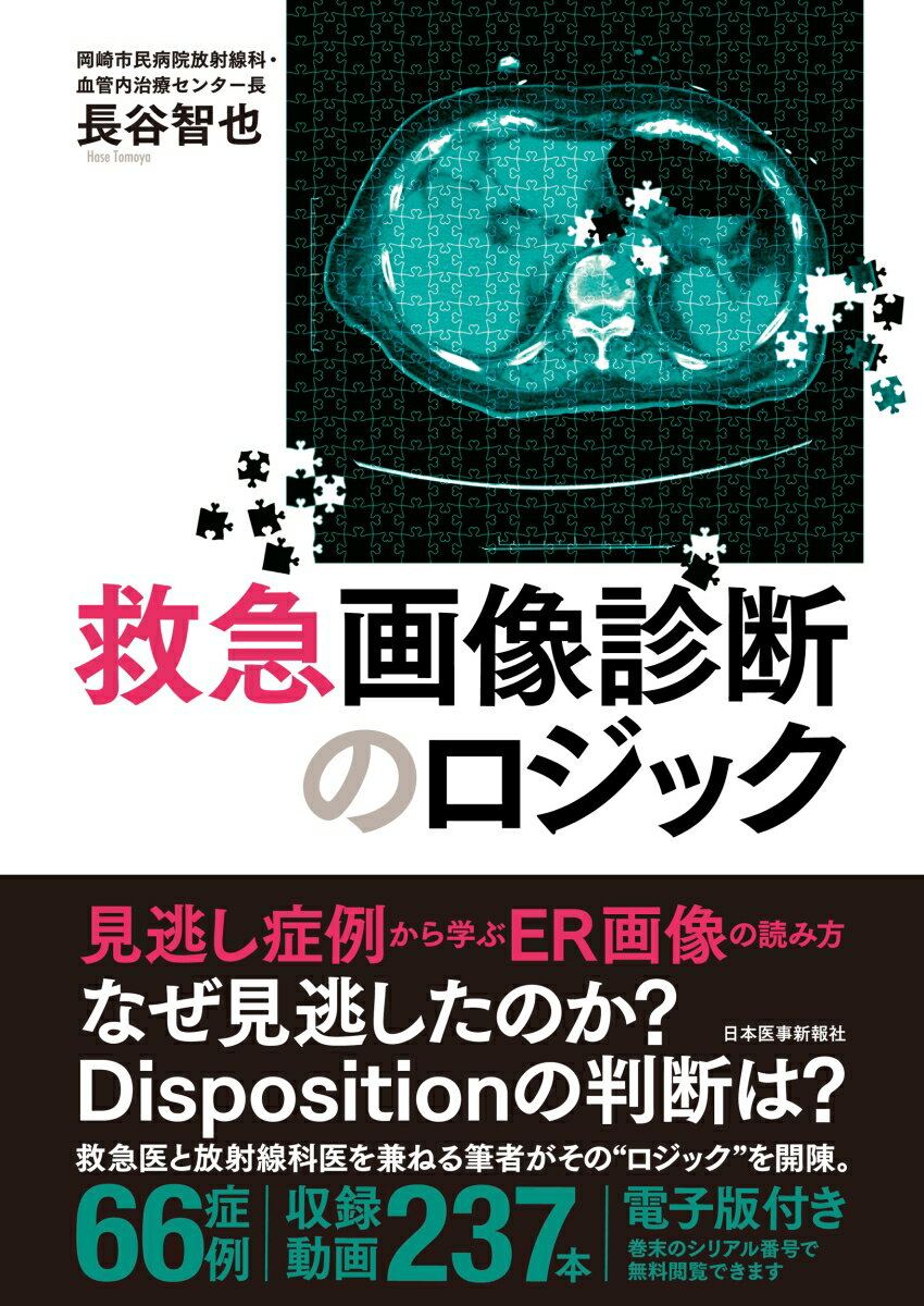 見逃し症例から学ぶＥＲ画像の読み方。なぜ見逃したのか？Ｄｉｓｐｏｓｉｔｉｏｎの判断は？救急医と放射線科医を兼ねる筆者がその“ロジック”を開陳。６６症例。収録動画２３７本。