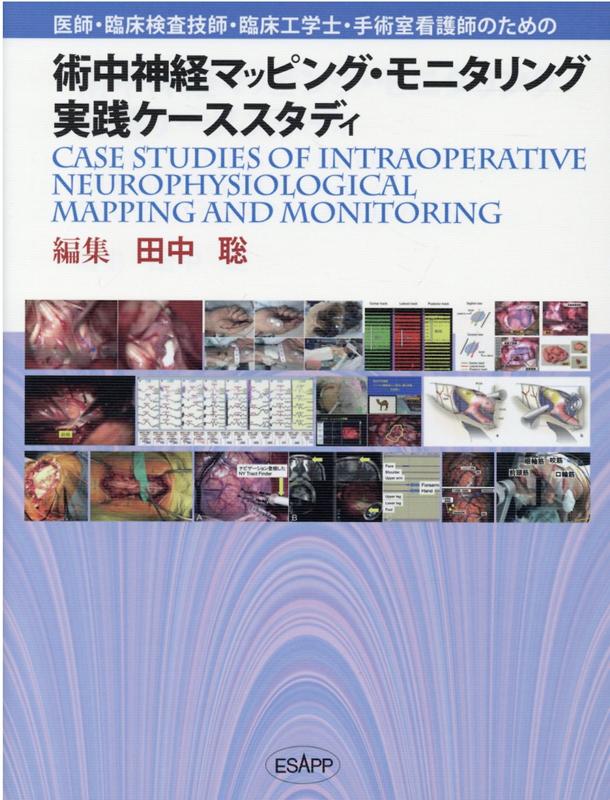 術中神経マッピング・モニタリング実践ケーススタディ