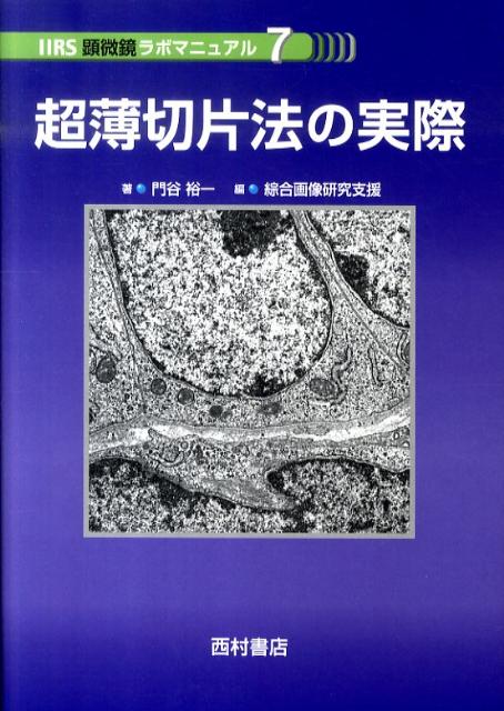 超薄切片法の実際 （IIRS顕微鏡ラボマニュアル） [ 門谷裕一 ]