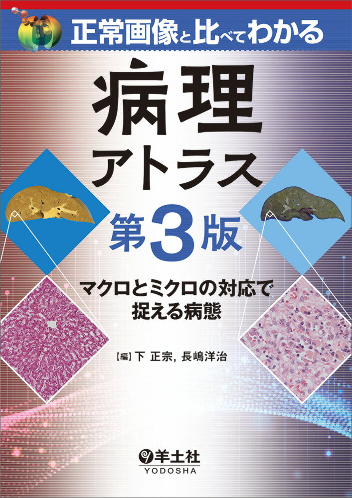 正常画像と比べてわかる 病理アトラス 第3版 [ 下 正宗 ]