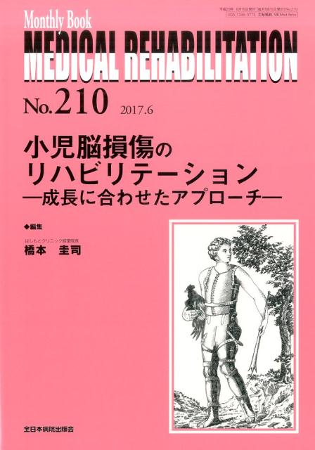 小児脳損傷のリハビリテーションー成長に合わせたアプローチー