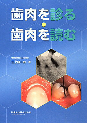 ブラッシング指導や治療で、歯肉をよく診て、読んでいると、患者の抱えている問題点が浮かび上がり、歯肉の変化を注意深く診たり、読んだりしていると、対応も的確になってくる。口の中をよく診て、患者をよく見て、観察し、考察し、理解する。