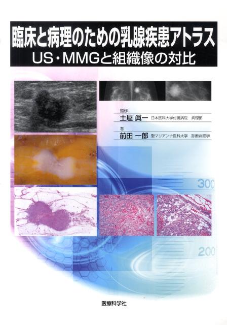 臨床と病理のための乳腺疾患アトラス