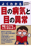 よくわかる目の病気と目の異常