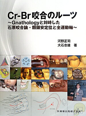 Cr-Br咬合のルーツ