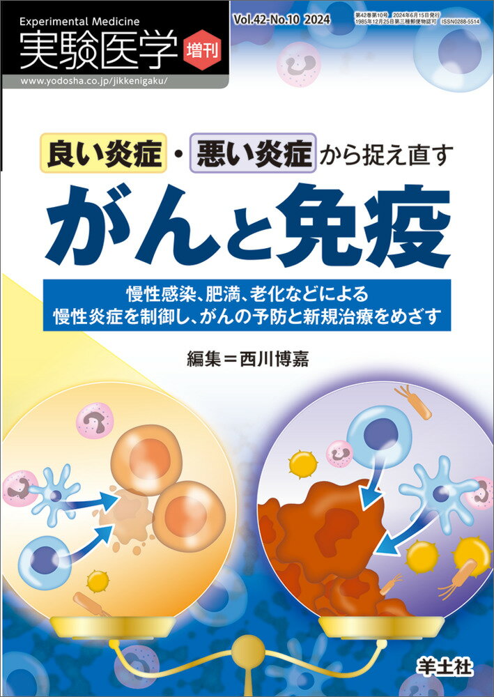 良い炎症・悪い炎症から捉え直すがんと免疫