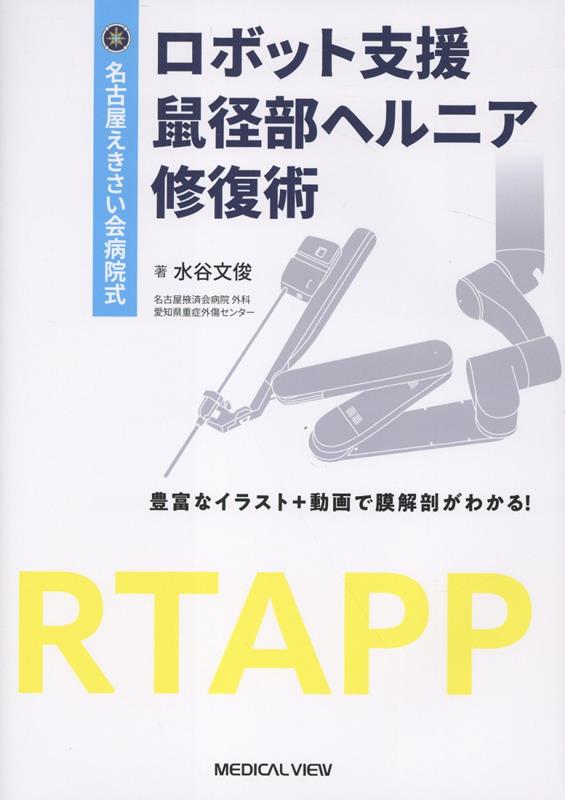 名古屋えきさい会病院式　ロボット支援鼠径部ヘルニア修復術
