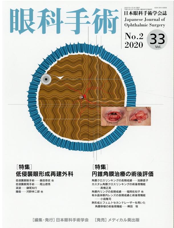 眼科手術（Vol．33 No．2（202）