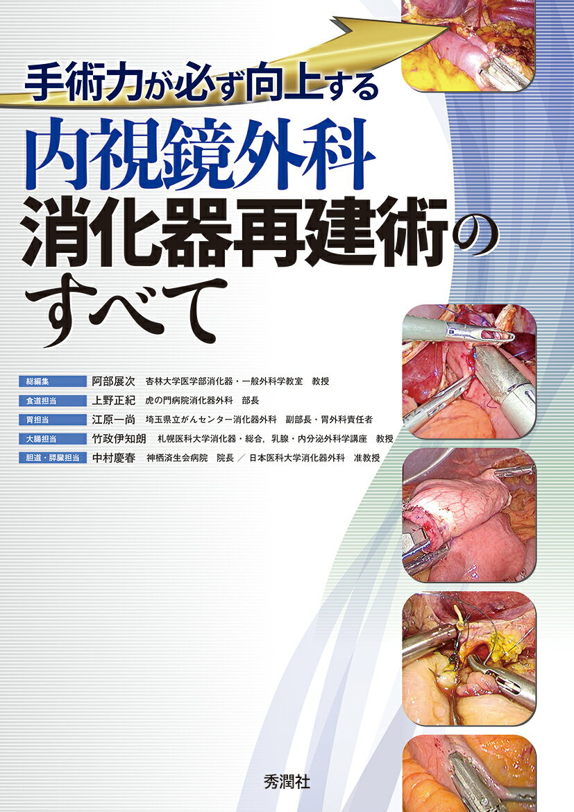 ４３の再建術を解説。消化器全領域に対応。流れがわかる手術動画、要点がわかる術中写真、ポイントをまとめた解説。消化器外科医がマスターすべき再建術のコツがわかる！