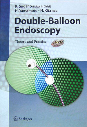Double-balloon　endoscopy