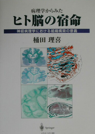 病理学からみたヒト脳の宿命