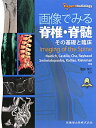 画像でみる脊椎 脊髄 その基礎と臨床 トーマス P．ナイジチ