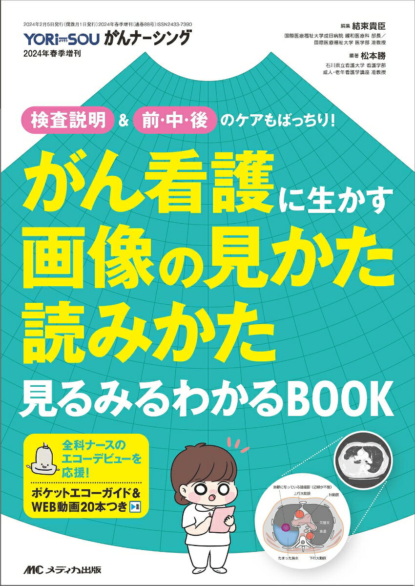 がん看護に生かす画像の見かた読みかた 見るみるわかるBOOK 検査説明＆前・中・後のケアもばっちり！ （YORi-SOU がんナーシング2024年春季増刊） 