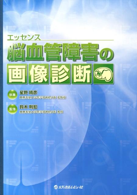 エッセンス脳血管障害の画像診断