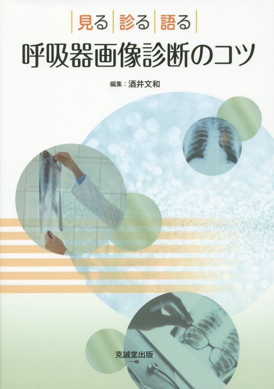 画像診断では、どのような点に着目し、重視するのか？どのような臨床所見に着目するのか？どの程度特異的なのか？鑑別に限界はあるのか？臨床検査・臨床所見の必要性は？ほかでは聞けない、エキスパートたちの本音とは？日本胸部臨床人気画像連載「本音で語る画像による鑑別診断のコツ」ついに単行本化！