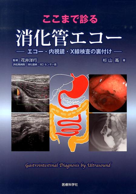 ここまで診る消化管エコー エコー 内視鏡 X線検査の裏付け 杉山高