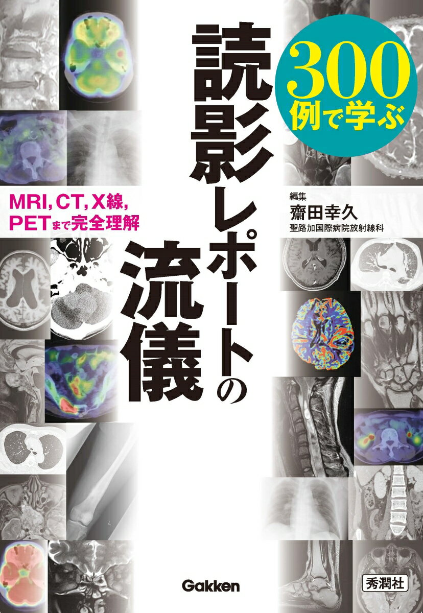 もう読影レポート作成で困らない！日常よく遭遇する全身３０９症例を１冊にまとめた。エキスパートがコツとヒントを伝授。