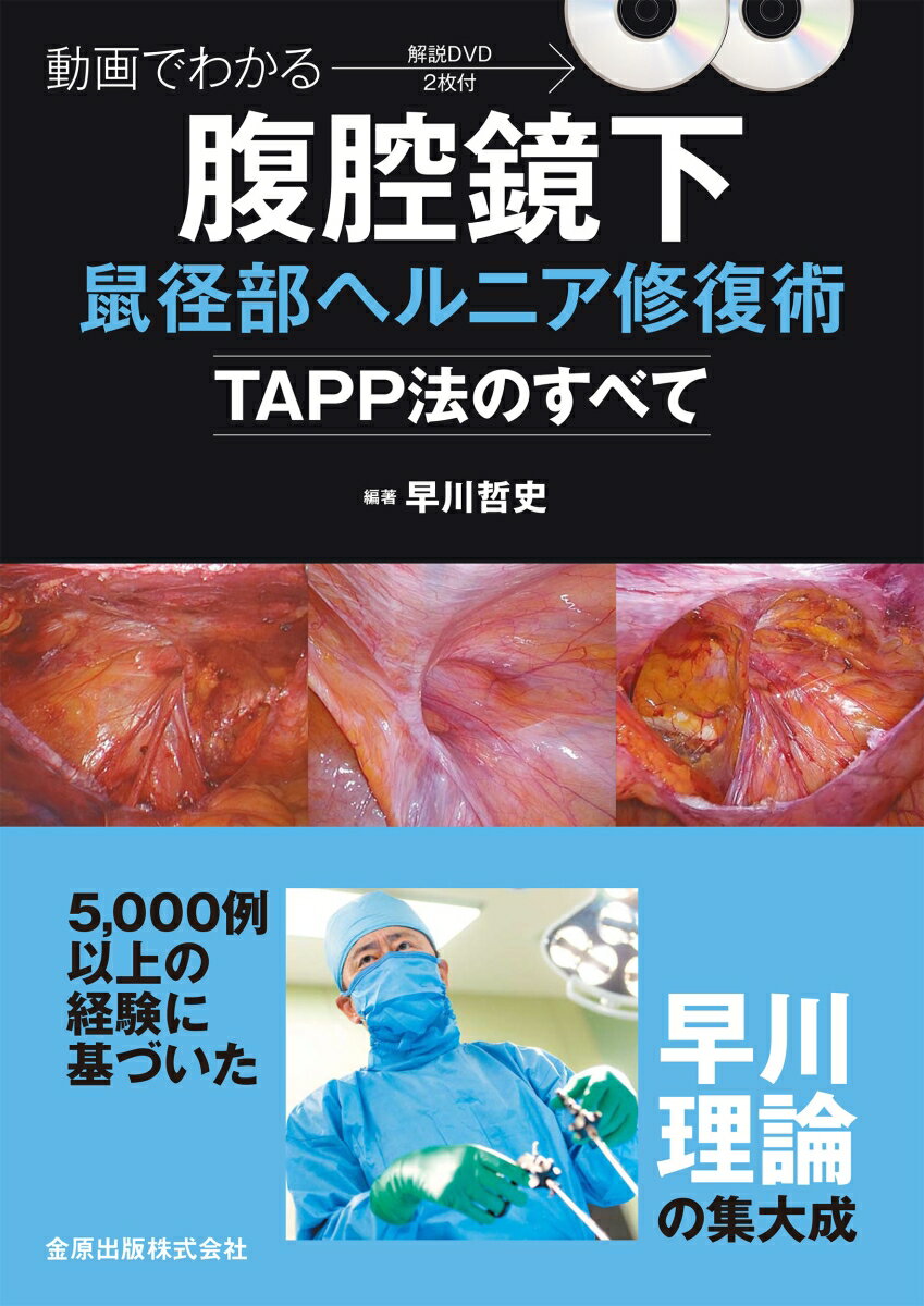 動画でわかる腹腔鏡下鼠径部ヘルニア修復術ーTAPP法のすべてー