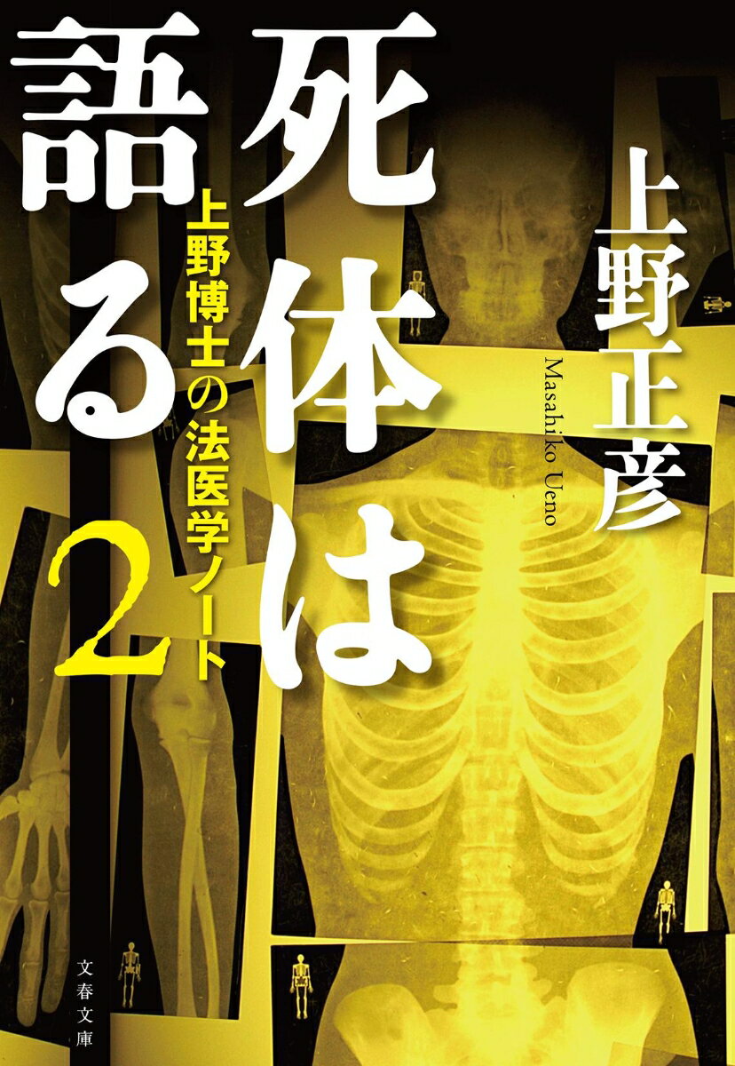 死体は語る2 上野博士の法医学ノート