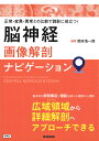 脳神経画像解剖ナビゲーション 正常 変異 異常との比較で読影に役立つ！ 岡本 浩一郎