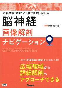 脳神経画像解剖ナビゲーション 正常・変異・異常との比較で読影に役立つ！ [ 岡本 浩一郎 ]