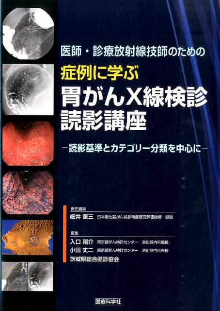 医師・診療放射線技師のための症例に学ぶ胃がんX線検診読影講座