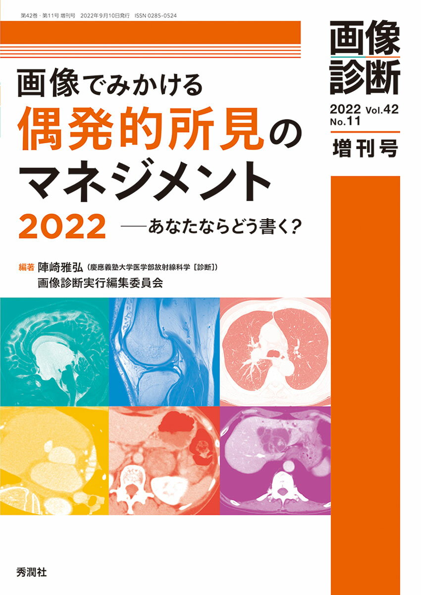 画像診断2022年増刊号Vol．42 No．11 画像でみかける偶発的所見のマネジメント2022-あなたならどう書く？ （画像診断増刊号） 陣崎雅弘
