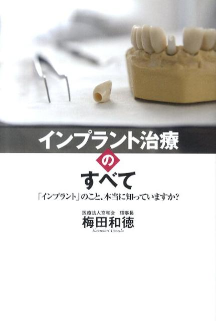 インプラント治療のすべて 「インプラント」のこと、本当に知っていますか？ [ 梅田和徳 ]