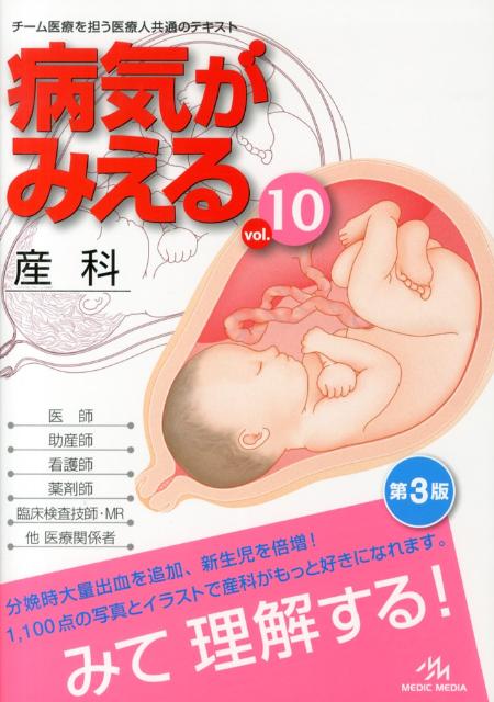 病気がみえる（10）第3版