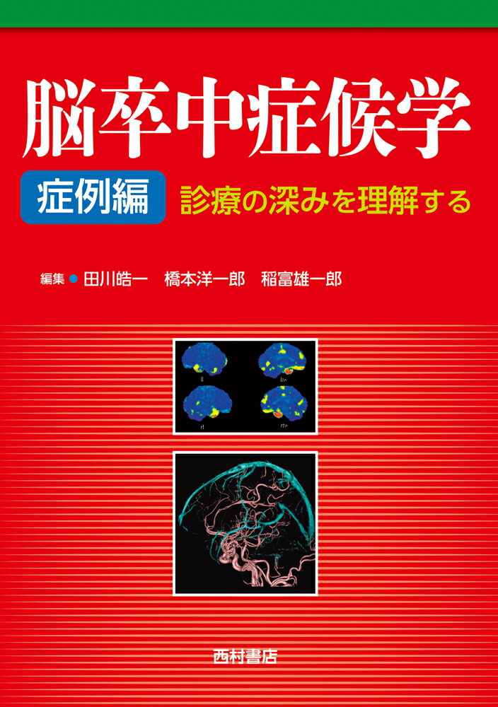 脳卒中症候学　症例編